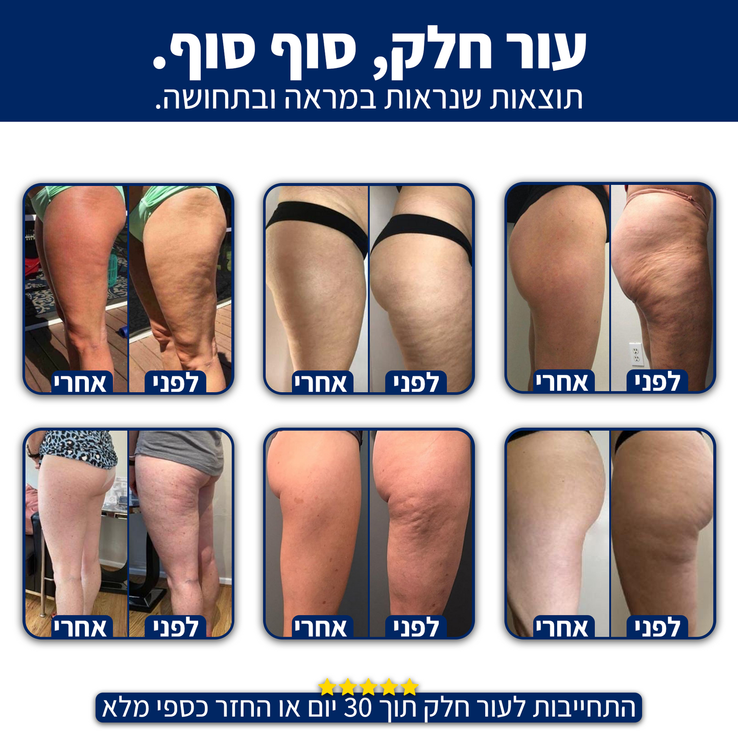 DrBella - טיפול חדשני בצלוליט מהבית