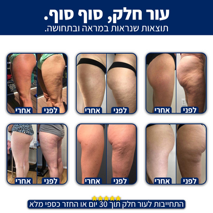 DrBella - טיפול חדשני בצלוליט מהבית