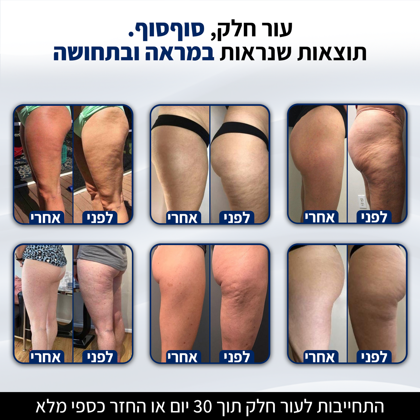 DrBella - טיפול להחלקת הצלוליט מהבית