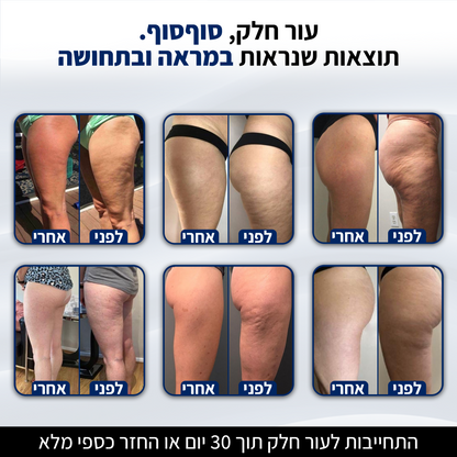 DrBella - טיפול להחלקת הצלוליט מהבית
